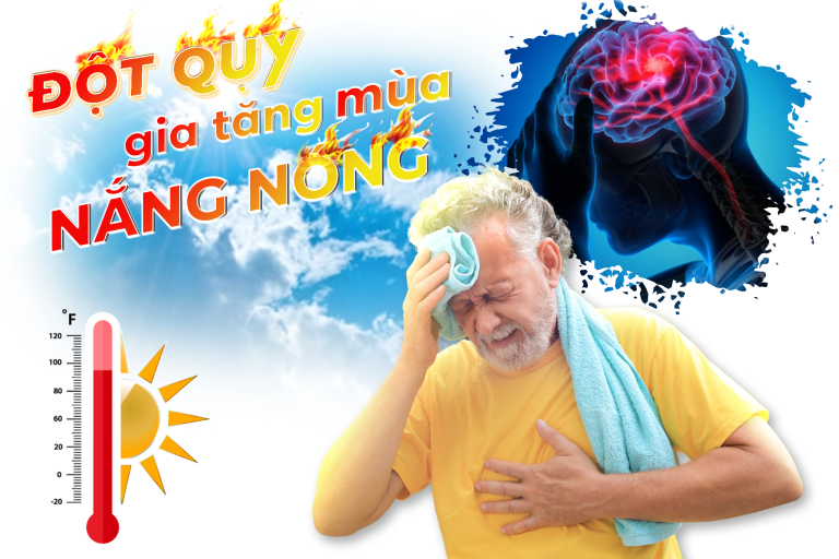 Đột quỵ